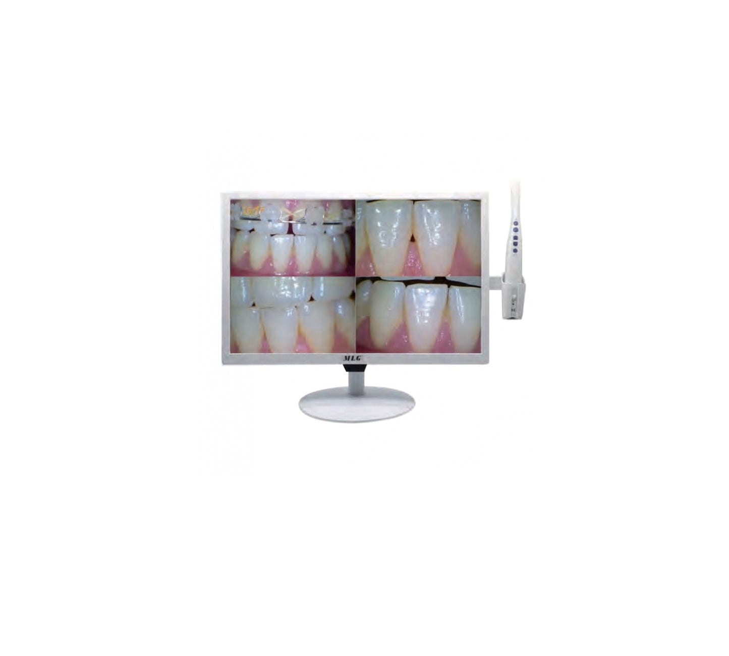 Camera Intraorala Wi-Fi 5G + Monitor 17" IC-91