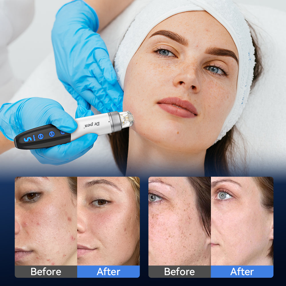 Dr.Pen Bio Pen Q1S – Microneedling cu EMS și LED pentru față și scalp