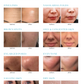 Aparat 10 în 1 Hydra Facial + Skin Analyzer