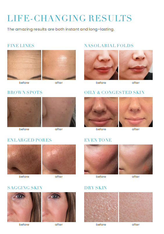 Aparat 10 în 1 Hydra Facial + Skin Analyzer