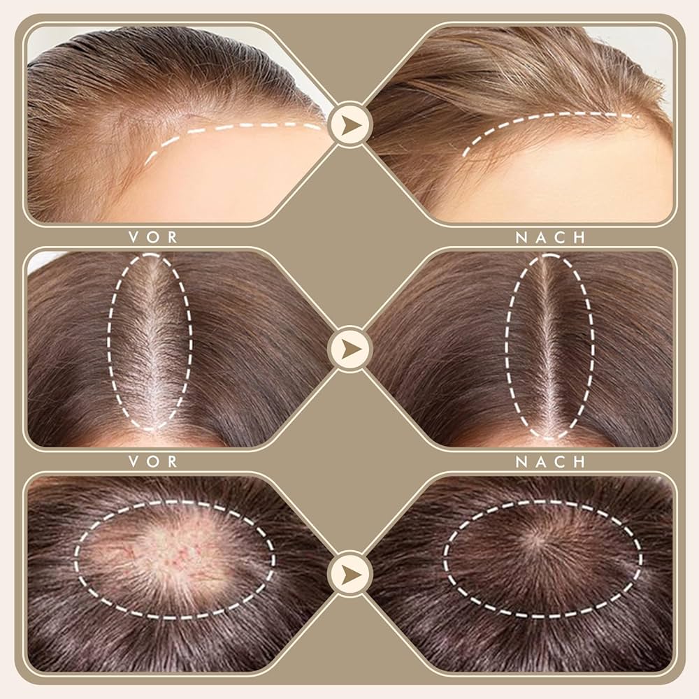 Dr. Pen Bio4 Derma Stamp – Microneedling Profesional pentru Rejuvenare, Riduri și Cicatrici