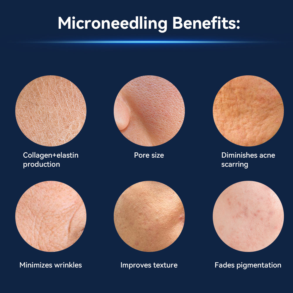Dr.Pen Bio Pen Q1S – Microneedling cu EMS și LED pentru față și scalp