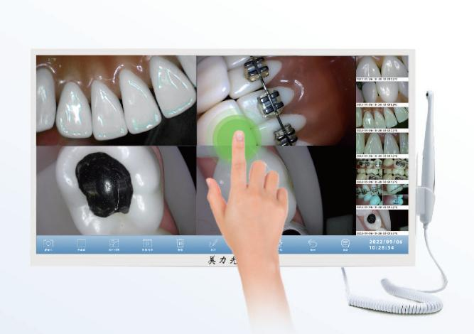 camera intraorala touch screen