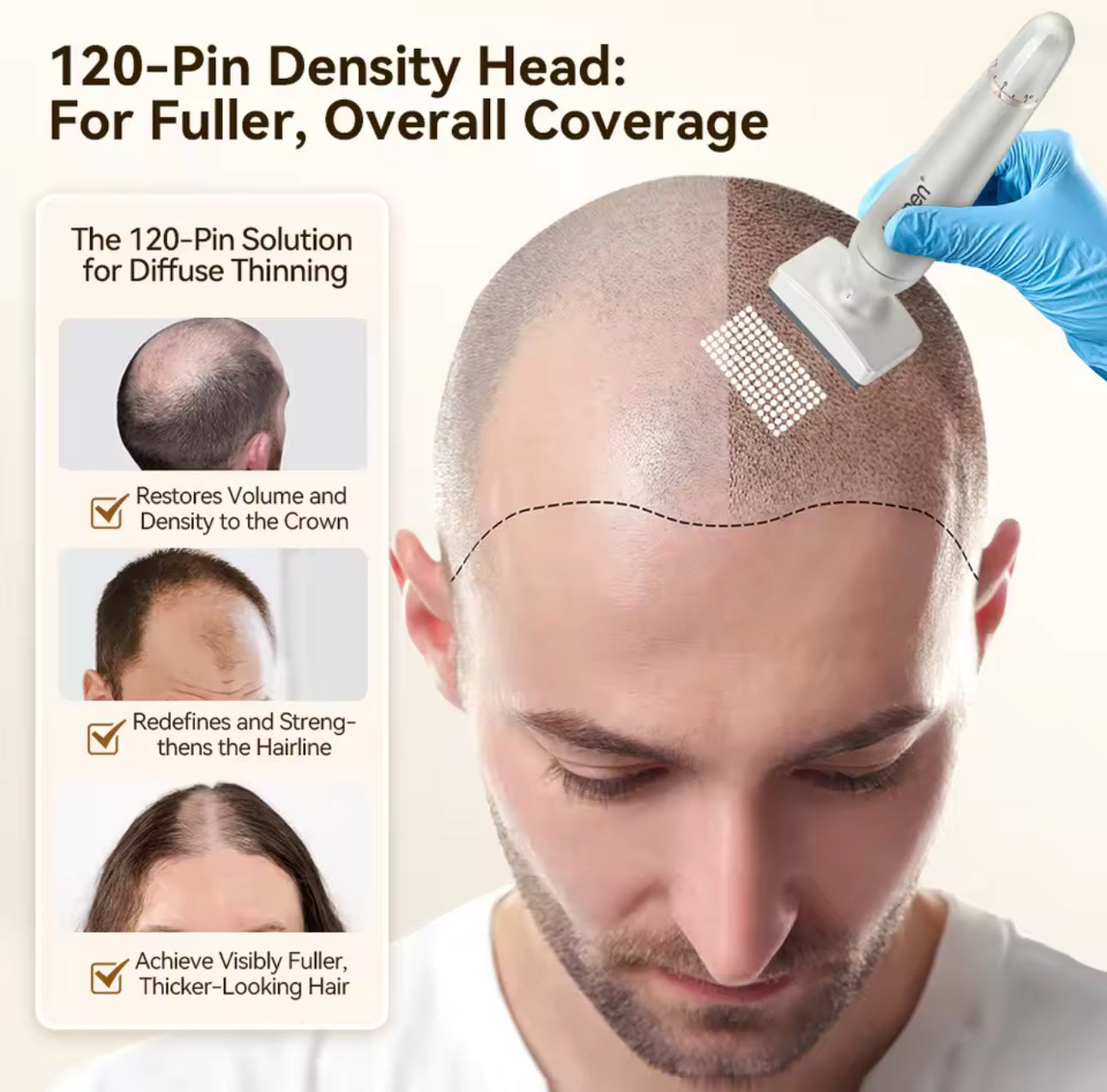 Dr. Pen Bio4 Derma Stamp – Microneedling Profesional pentru Rejuvenare, Riduri și Cicatrici