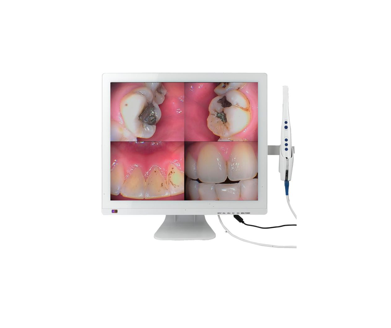 Camera intraorala cu monitor IC-978