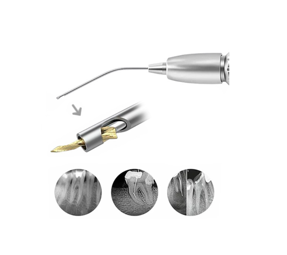 Sistem de indepartat ace fracturate EF-E15
